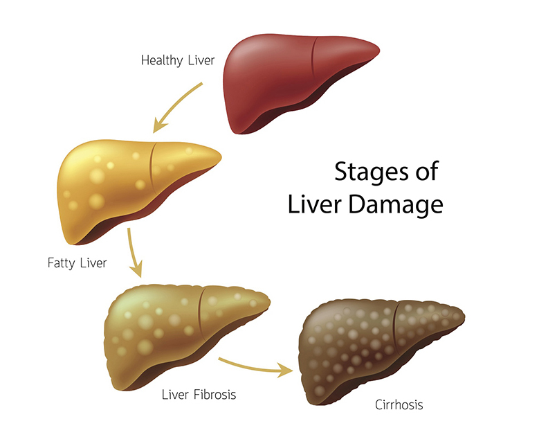 Study Shows How Liver Damage from Stress and Aging Might Be Reversible |  Duke Health
